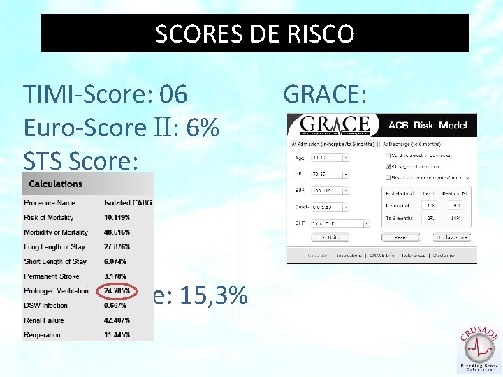 SCORES DE RISCO TIMI-Score: 06 Euro-Score II: 6% STS Score: Crusade: 15, 3% GRACE: