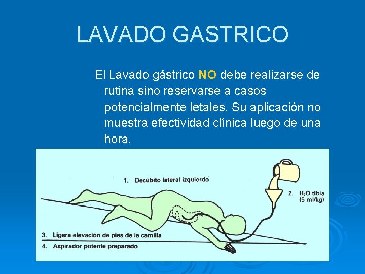 LAVADO GASTRICO El Lavado gástrico NO debe realizarse de rutina sino reservarse a casos
