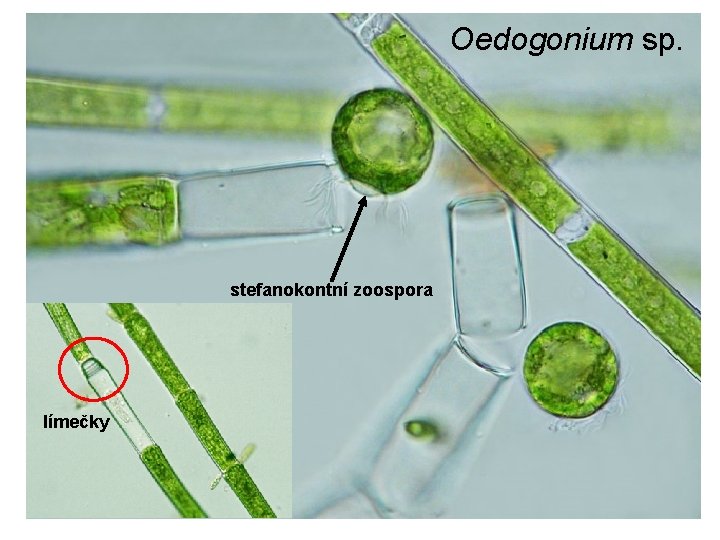 Oedogonium sp. stefanokontní zoospora límečky 