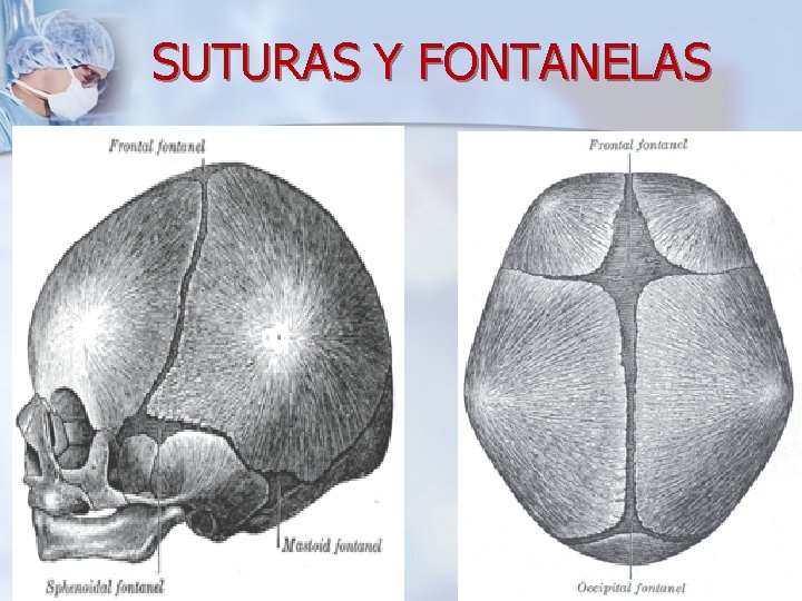 SUTURAS Y FONTANELAS 