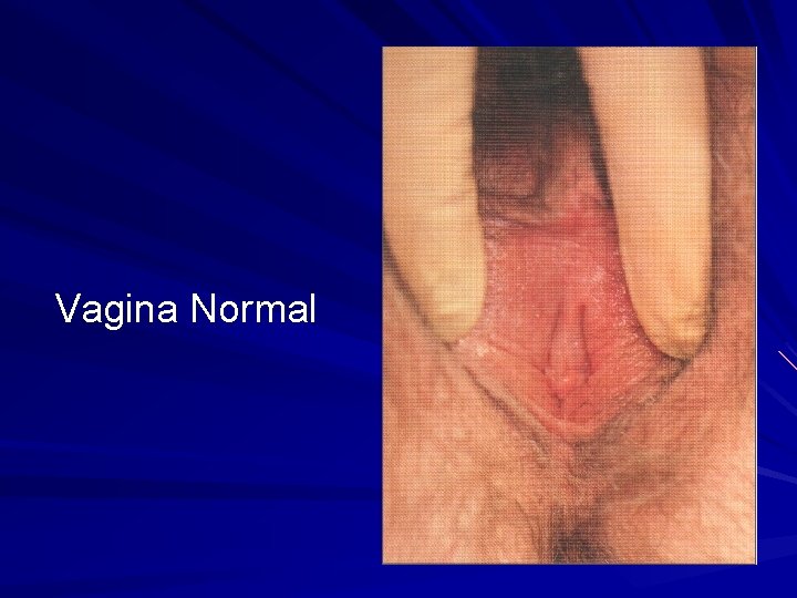 Gambar vagina yang normal