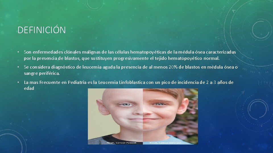 DEFINICIÓN • Son enfermedades clónales malignas de las células hematopoyéticas de la médula ósea