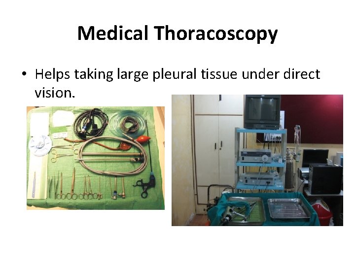 Medical Thoracoscopy • Helps taking large pleural tissue under direct vision. 