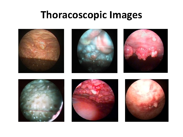 Thoracoscopic Images 