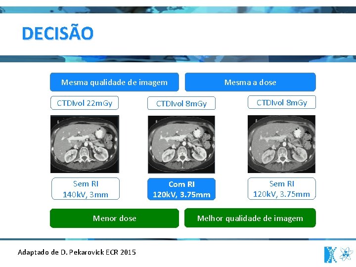 DECISÃO Mesma qualidade de imagem Mesma a dose CTDIvol 22 m. Gy CTDIvol 8