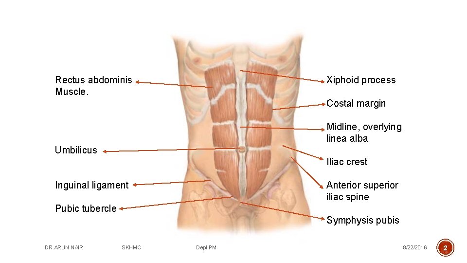 Rectus abdominis Muscle. Xiphoid process Costal margin Midline, overlying linea alba Umbilicus Iliac crest