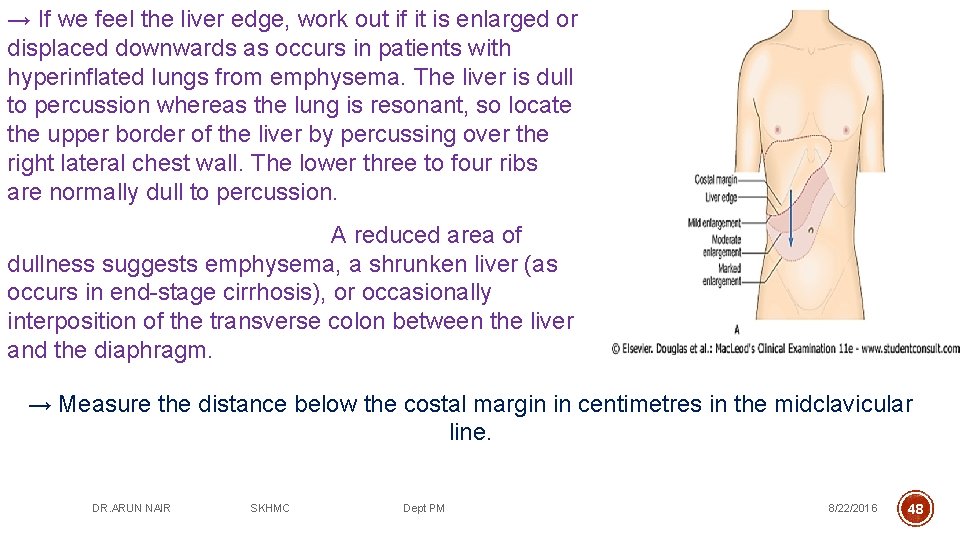 → If we feel the liver edge, work out if it is enlarged or