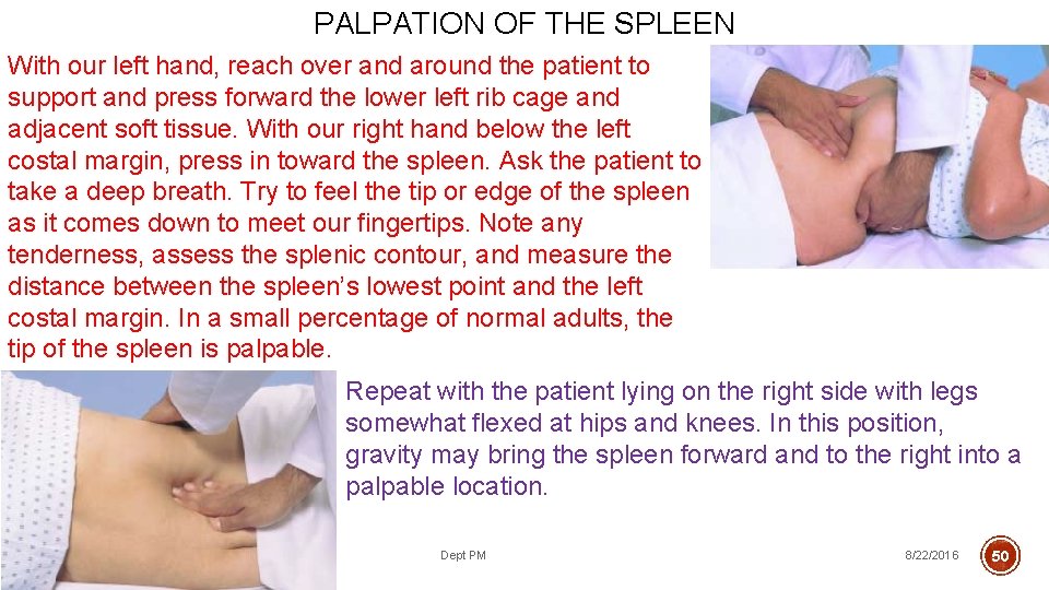 PALPATION OF THE SPLEEN With our left hand, reach over and around the patient