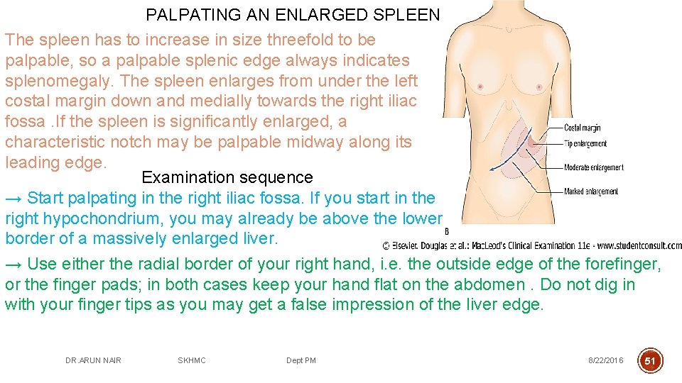 PALPATING AN ENLARGED SPLEEN The spleen has to increase in size threefold to be