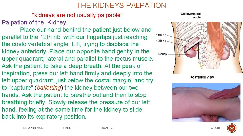 THE KIDNEYS-PALPATION “kidneys are not usually palpable” Palpation of the Kidney. Place our hand