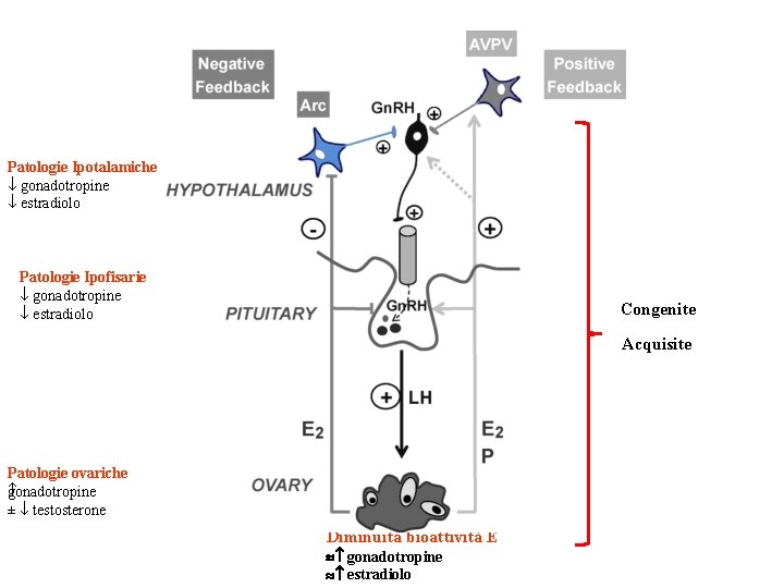 Patologie Ipotalamiche gonadotropine estradiolo Patologie Ipofisarie gonadotropine estradiolo Congenite Acquisite Patologie ovariche gonadotropine ±