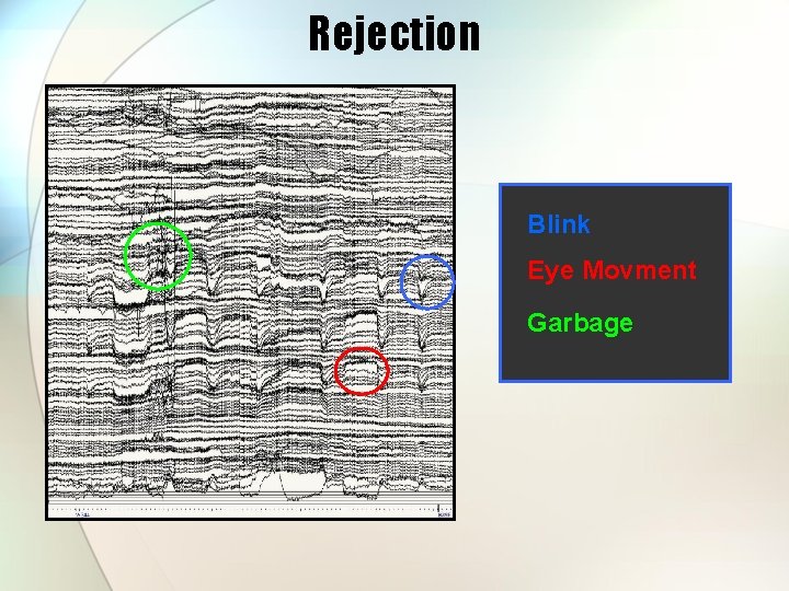 Rejection Blink Eye Movment Garbage 