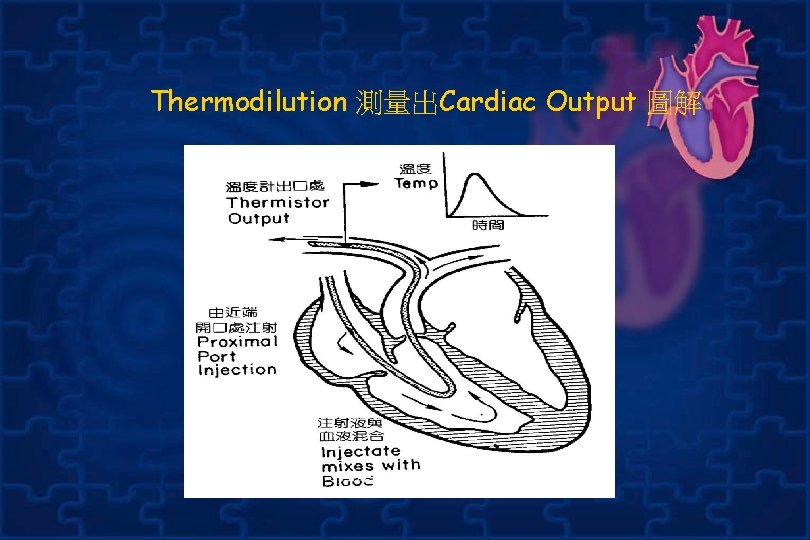  Thermodilution 測量出Cardiac Output 圖解 