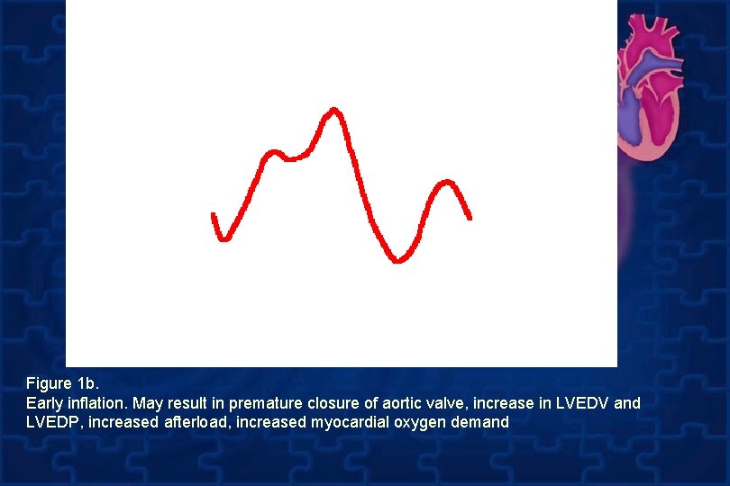  Figure 1 b. Early inflation. May result in premature closure of aortic valve,