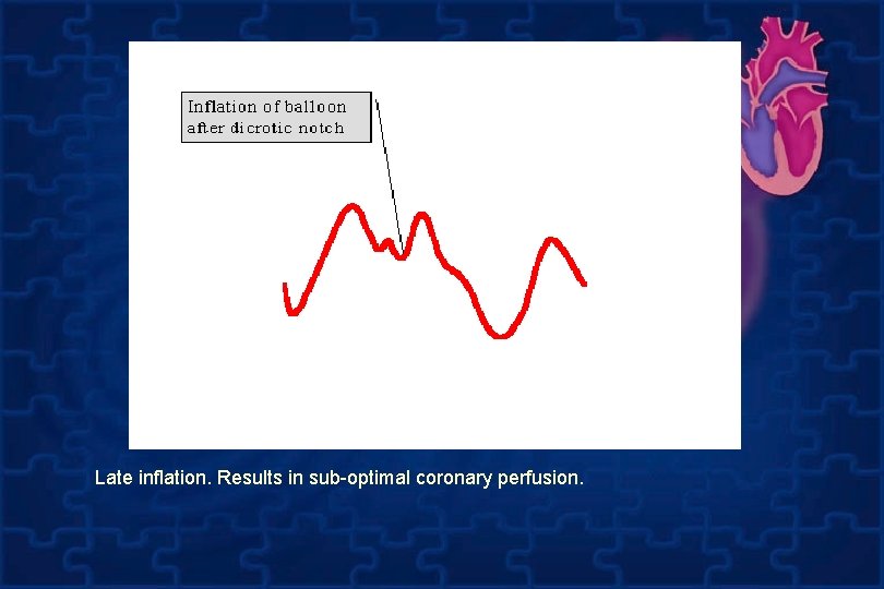 Late inflation. Results in sub-optimal coronary perfusion. 