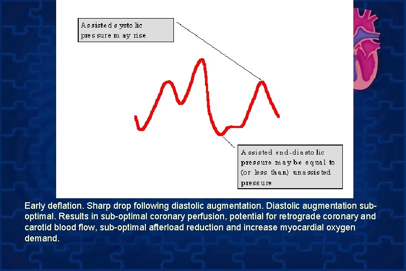 Early deflation. Sharp drop following diastolic augmentation. Diastolic augmentation suboptimal. Results in sub-optimal coronary