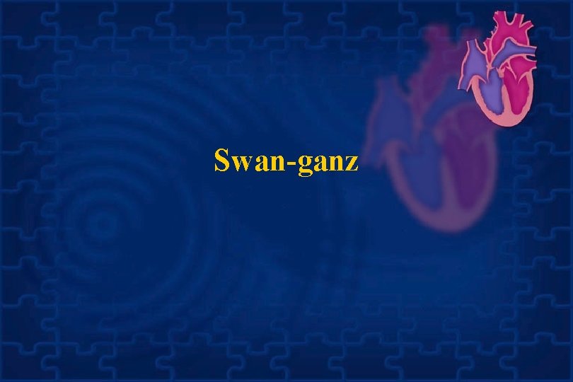 Swan-ganz 