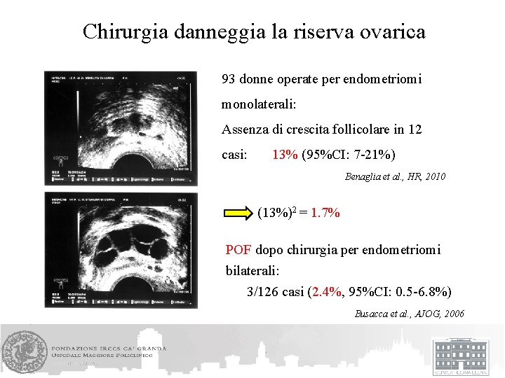 Chirurgia danneggia la riserva ovarica 93 donne operate per endometriomi monolaterali: Assenza di crescita