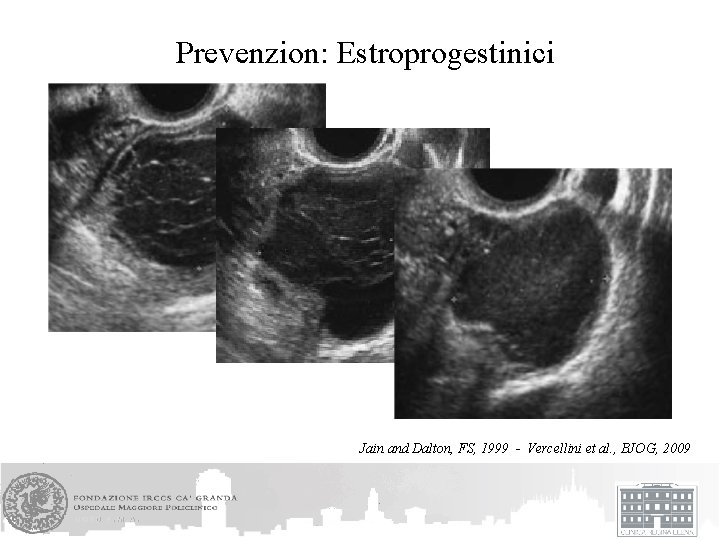 Prevenzion: Estroprogestinici Jain and Dalton, FS, 1999 - Vercellini et al. , BJOG, 2009