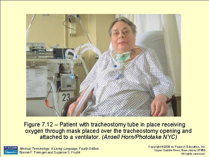 Figure 7. 12 – Patient with tracheostomy tube in place receiving oxygen through mask