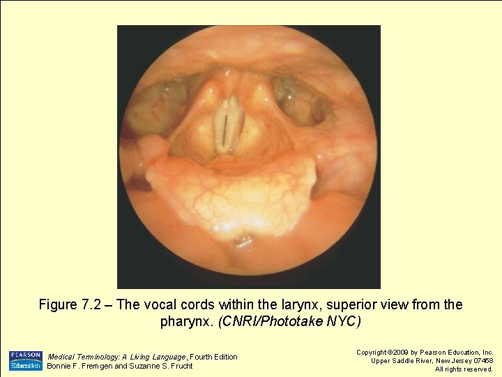 Figure 7. 2 – The vocal cords within the larynx, superior view from the