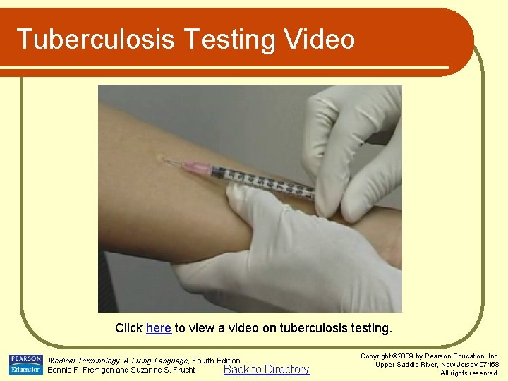 Tuberculosis Testing Video Click here to view a video on tuberculosis testing. Medical Terminology: