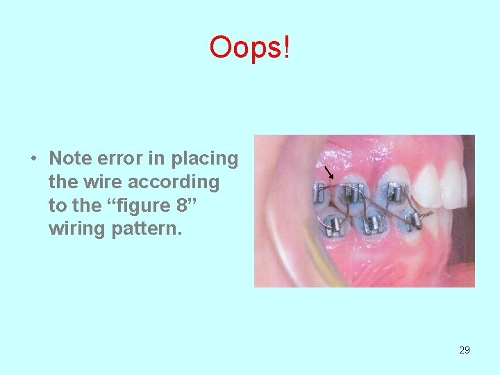Oops! • Note error in placing the wire according to the “figure 8” wiring