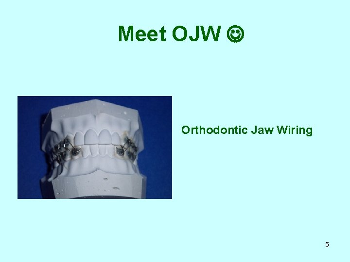 Meet OJW Orthodontic Jaw Wiring 5 