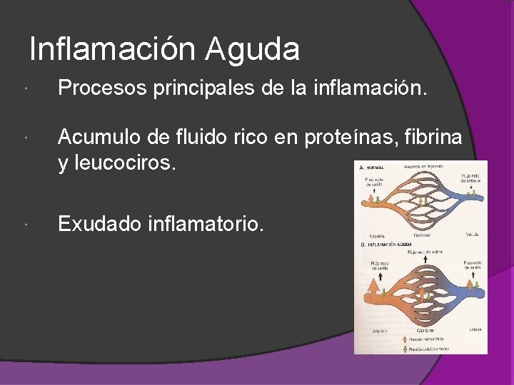 Inflamación Aguda Procesos principales de la inflamación. Acumulo de fluido rico en proteínas, fibrina Inflamación Aguda Procesos principales de la inflamación. Acumulo de fluido rico en proteínas, fibrina