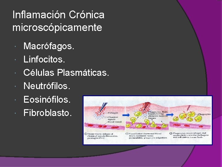 Inflamación Crónica microscópicamente Macrófagos. Linfocitos. Células Plasmáticas. Neutrófilos. Eosinófilos. Fibroblasto. Inflamación Crónica microscópicamente Macrófagos. Linfocitos. Células Plasmáticas. Neutrófilos. Eosinófilos. Fibroblasto.