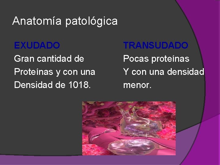 Anatomía patológica EXUDADO Gran cantidad de Proteínas y con una Densidad de 1018. TRANSUDADO Anatomía patológica EXUDADO Gran cantidad de Proteínas y con una Densidad de 1018. TRANSUDADO