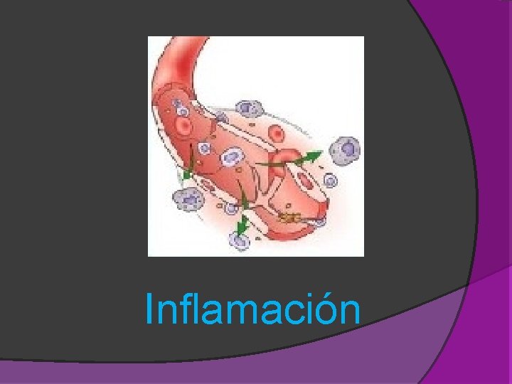 Inflamación Inflamación