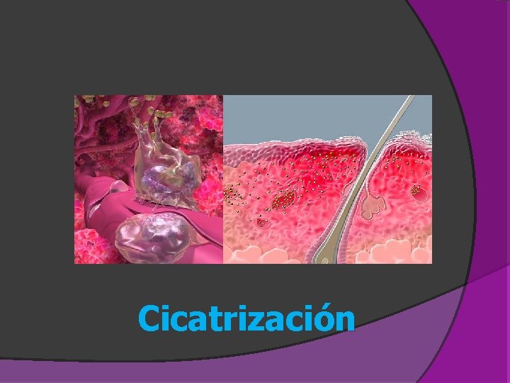 Cicatrización Cicatrización