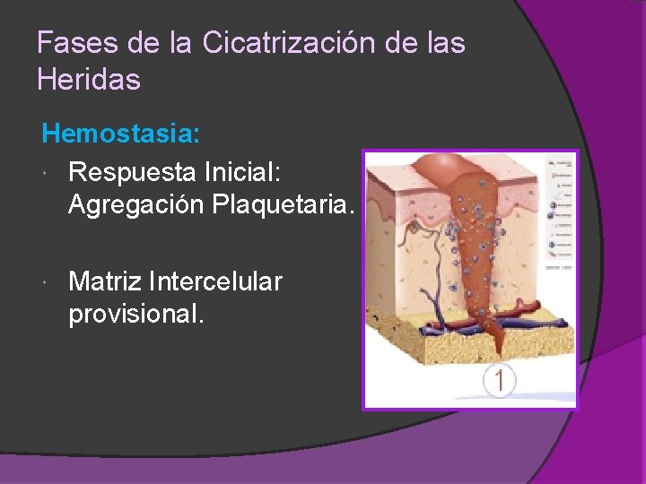 Fases de la Cicatrización de las Heridas Hemostasia: Respuesta Inicial: Agregación Plaquetaria. Matriz Intercelular Fases de la Cicatrización de las Heridas Hemostasia: Respuesta Inicial: Agregación Plaquetaria. Matriz Intercelular