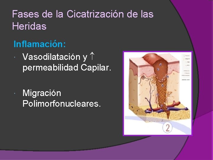 Fases de la Cicatrización de las Heridas Inflamación: Vasodilatación y permeabilidad Capilar. Migración Polimorfonucleares. Fases de la Cicatrización de las Heridas Inflamación: Vasodilatación y permeabilidad Capilar. Migración Polimorfonucleares.