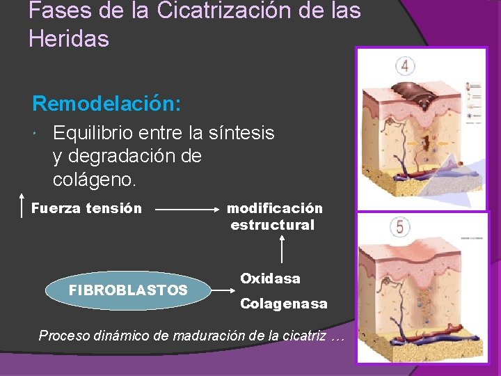 Fases de la Cicatrización de las Heridas Remodelación: Equilibrio entre la síntesis y degradación Fases de la Cicatrización de las Heridas Remodelación: Equilibrio entre la síntesis y degradación