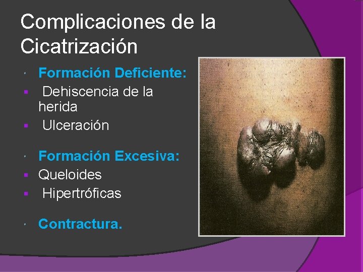 Complicaciones de la Cicatrización Formación Deficiente: § Dehiscencia de la herida § Ulceración Formación Complicaciones de la Cicatrización Formación Deficiente: § Dehiscencia de la herida § Ulceración Formación