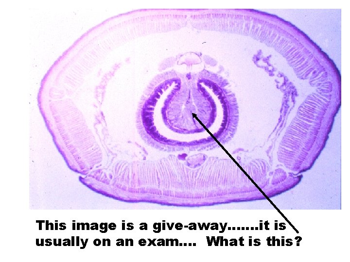 This image is a give-away……. it is usually on an exam…. What is this?