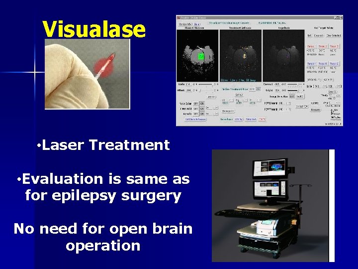 Visualase • Laser Treatment • Evaluation is same as for epilepsy surgery No need