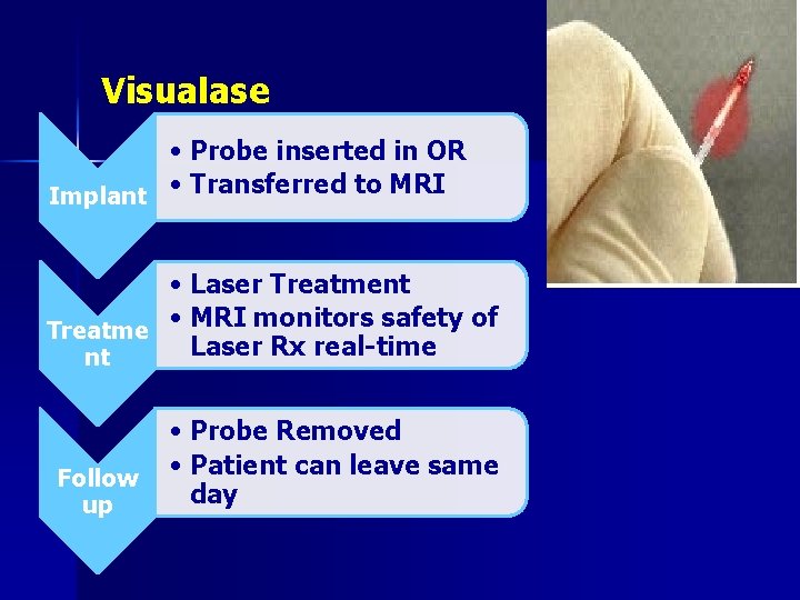 Visualase • Probe inserted in OR Implant • Transferred to MRI • Laser Treatment