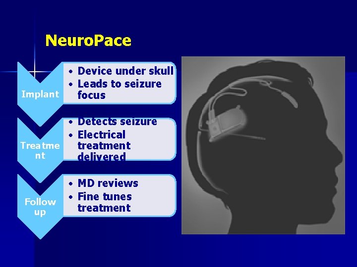 Neuro. Pace • Device under skull • Leads to seizure Implant focus • Detects