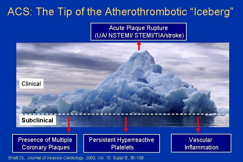 ACS: The Tip of the Atherothrombotic “Iceberg” Acute Plaque Rupture (UA/ NSTEMI/TIA/stroke) Clinical Subclinical