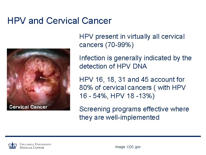 HPV and Cervical Cancer HPV present in virtually all cervical cancers (70 -99%) Infection