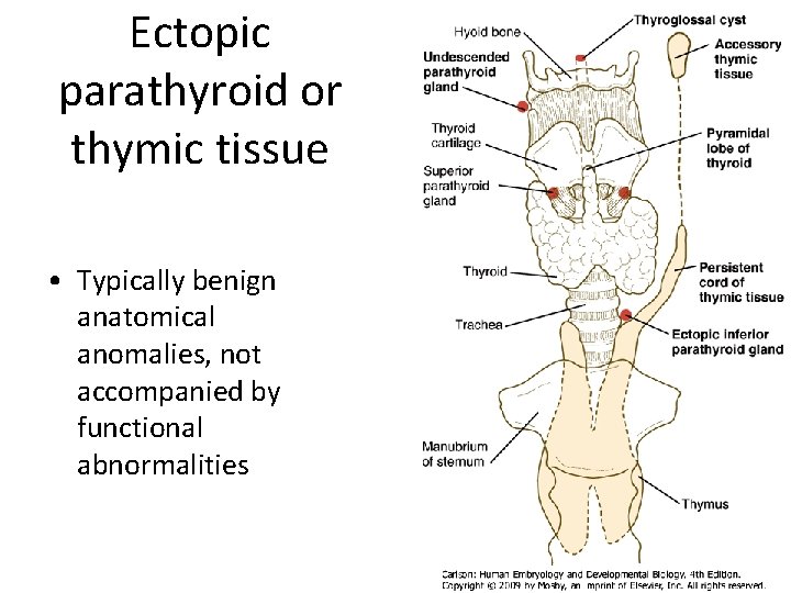 Ectopic parathyroid or thymic tissue • Typically benign anatomical anomalies, not accompanied by functional