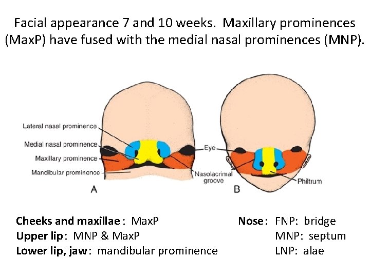 Facial appearance 7 and 10 weeks. Maxillary prominences (Max. P) have fused with the