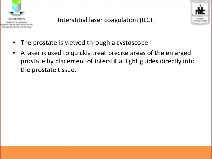Interstitial laser coagulation (ILC). • The prostate is viewed through a cystoscope. • A