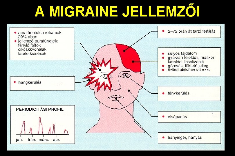 A MIGRAINE JELLEMZŐI 