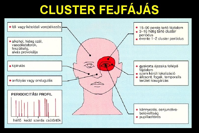 CLUSTER FEJFÁJÁS 
