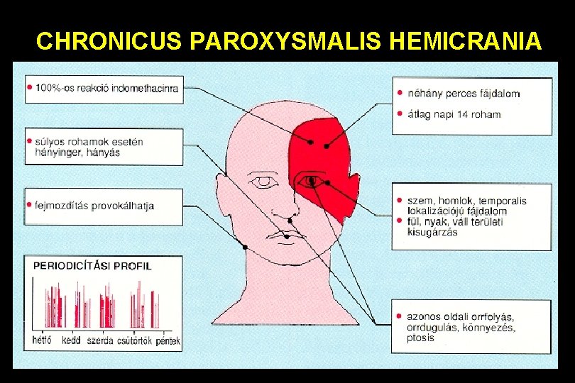 CHRONICUS PAROXYSMALIS HEMICRANIA 
