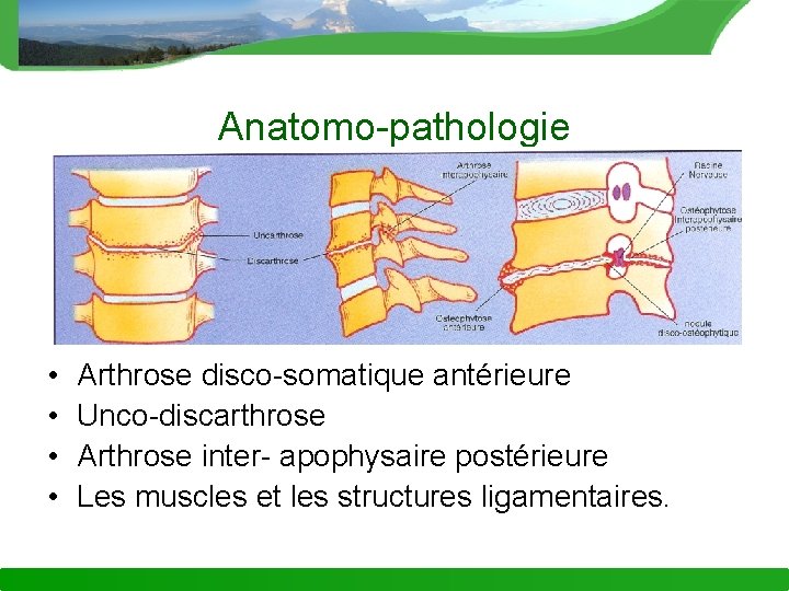 Anatomo-pathologie • • Arthrose disco-somatique antérieure Unco-discarthrose Arthrose inter- apophysaire postérieure Les muscles et
